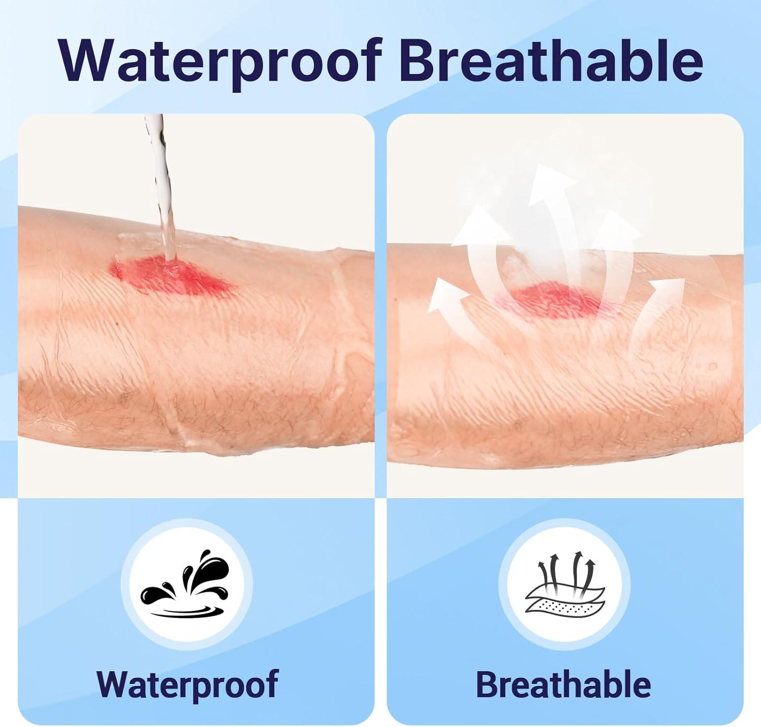 image:image50 Pack Transparent Film Dressing 4 x 475 Waterproof Bandages Breathable Hypoallergenic Adhesive Patch for Post Surgical Shower IV Shield Tattoo Aftercare4 x 475