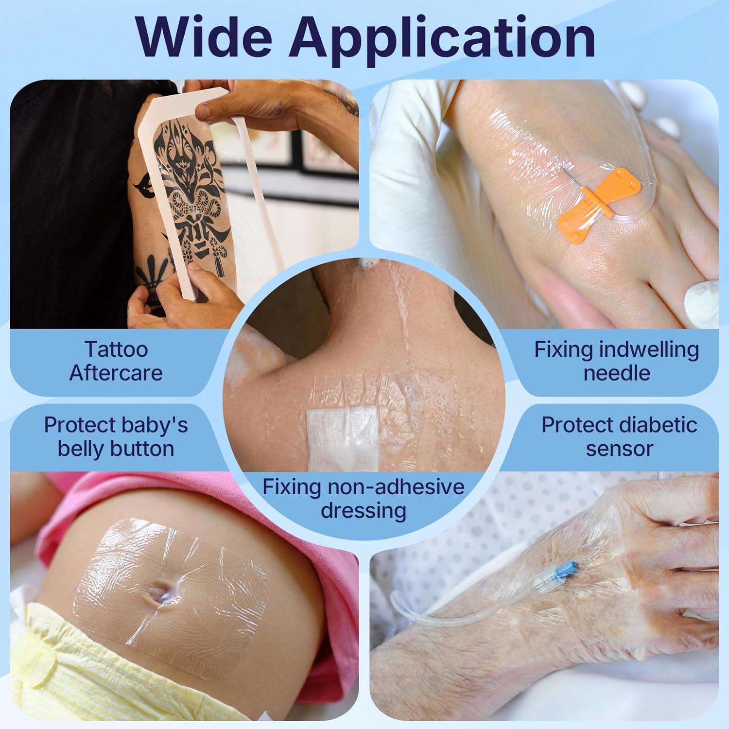 image:image50 Pack Transparent Film Dressing 4 x 475 Waterproof Bandages Breathable Hypoallergenic Adhesive Patch for Post Surgical Shower IV Shield Tattoo Aftercare6 x 8