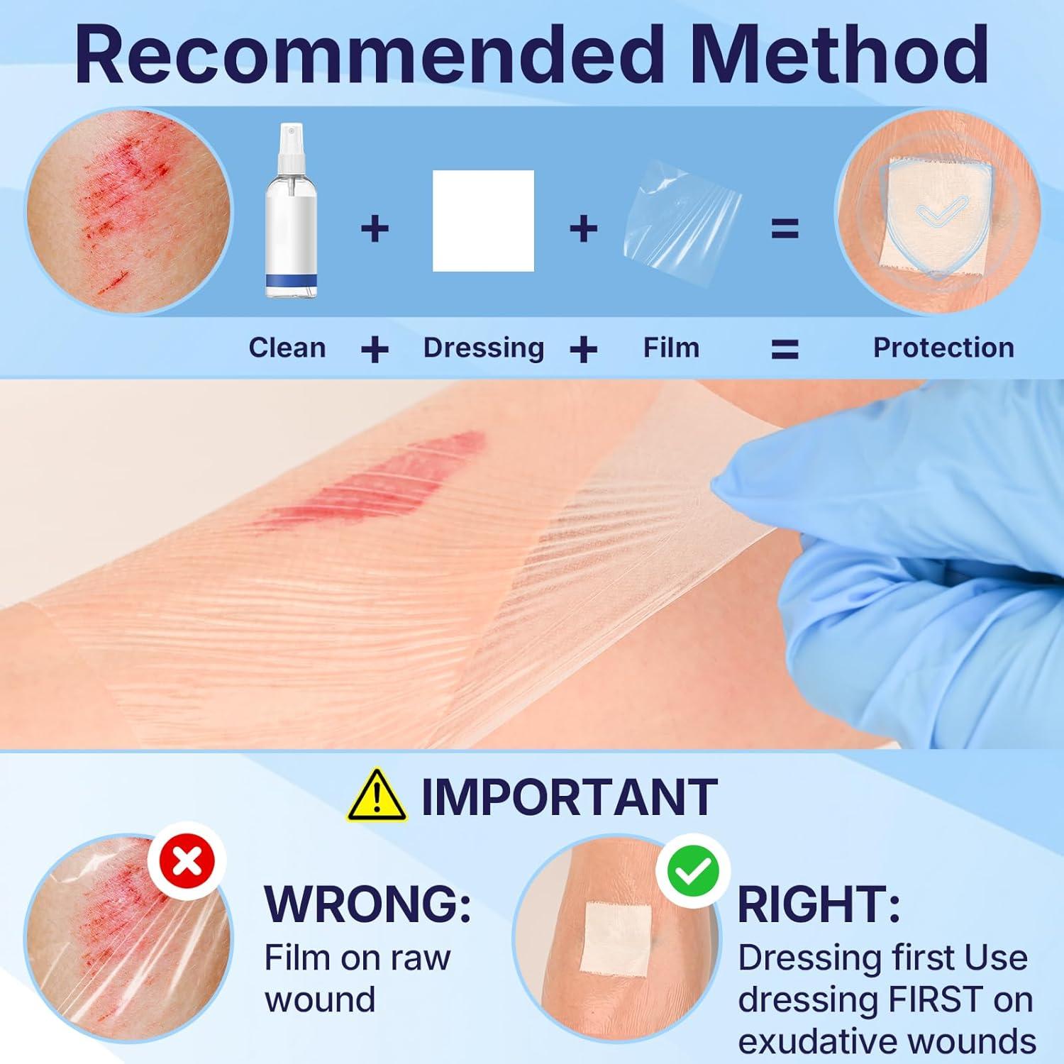 image:image50 Pack Transparent Film Dressing 4 x 475 Waterproof Bandages Breathable Hypoallergenic Adhesive Patch for Post Surgical Shower IV Shield Tattoo Aftercare4 x 475