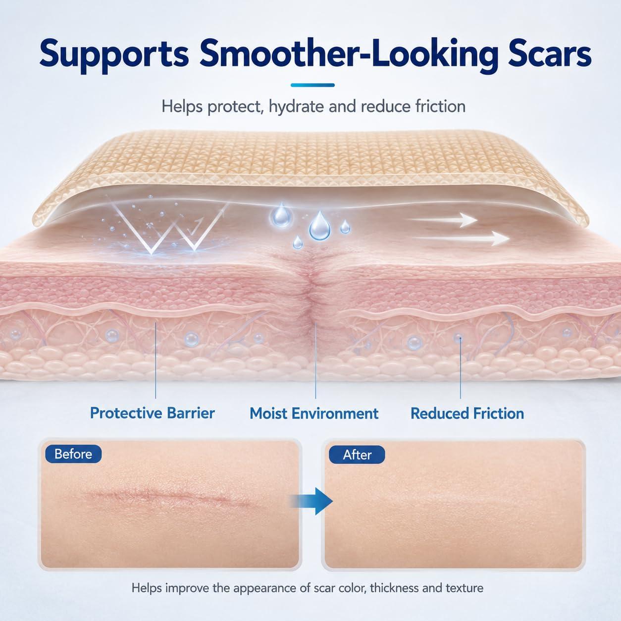 image:imageSilicone Scar Tape 16 x 79 Roll2M Medical Grade Silicone Scar Sheets for CSection Surgery Burns Acne Tummy Tuck and Keloid Care PreCut Reusable4M